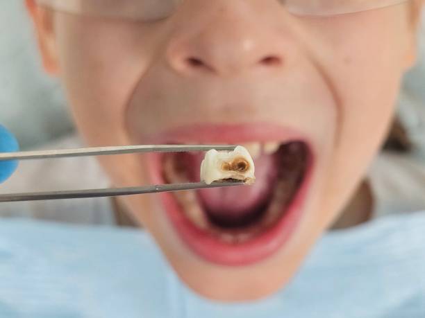 Best Cosmetic Emergency Dentistry in Wickerham Manor Fisher, PA