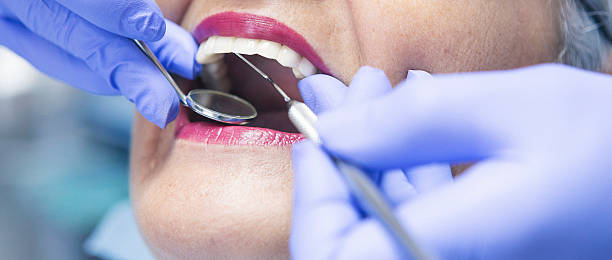 Best Emergency Wisdom Teeth Removal in Wickerham Manor Fisher, PA